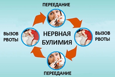 Лечение булимии в Суздали